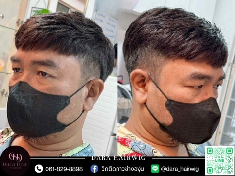 วิกผมสำหรับคนหัวล้าน